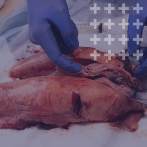 Don't Hold Your Breath (Ventilators 101)